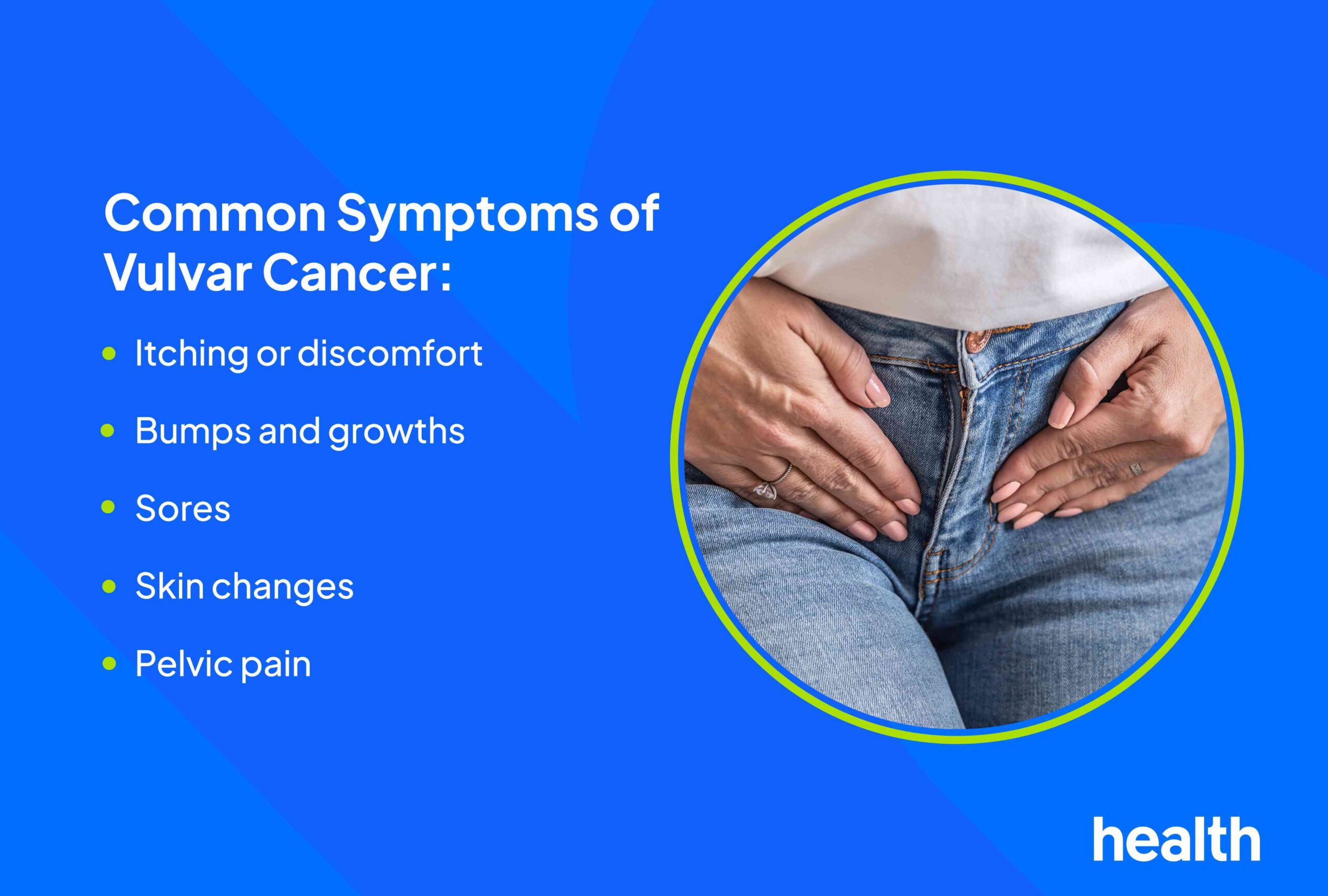 Vulvar Cancer: Signs and Symptoms